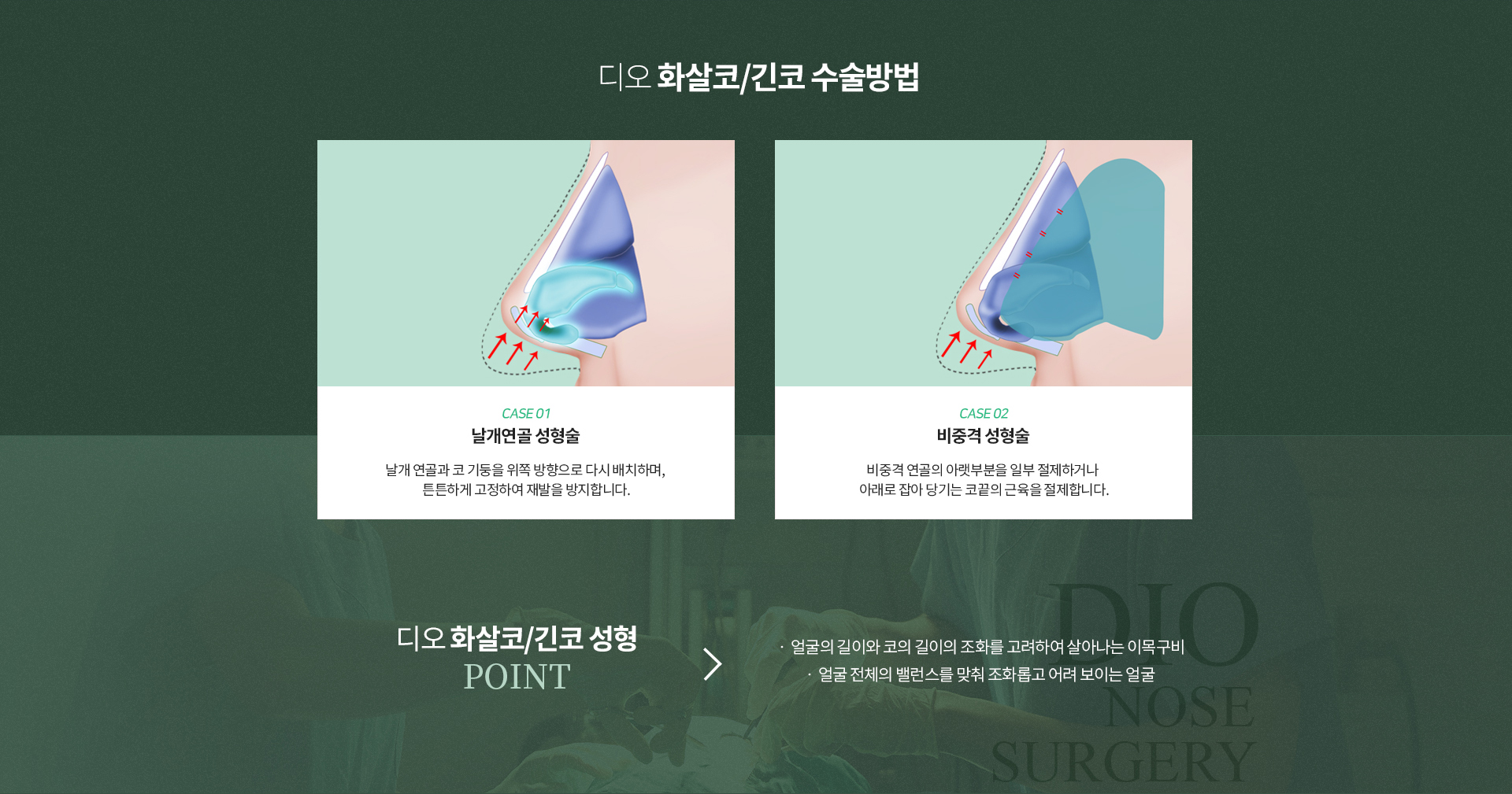 화살코/긴코성형수술방법