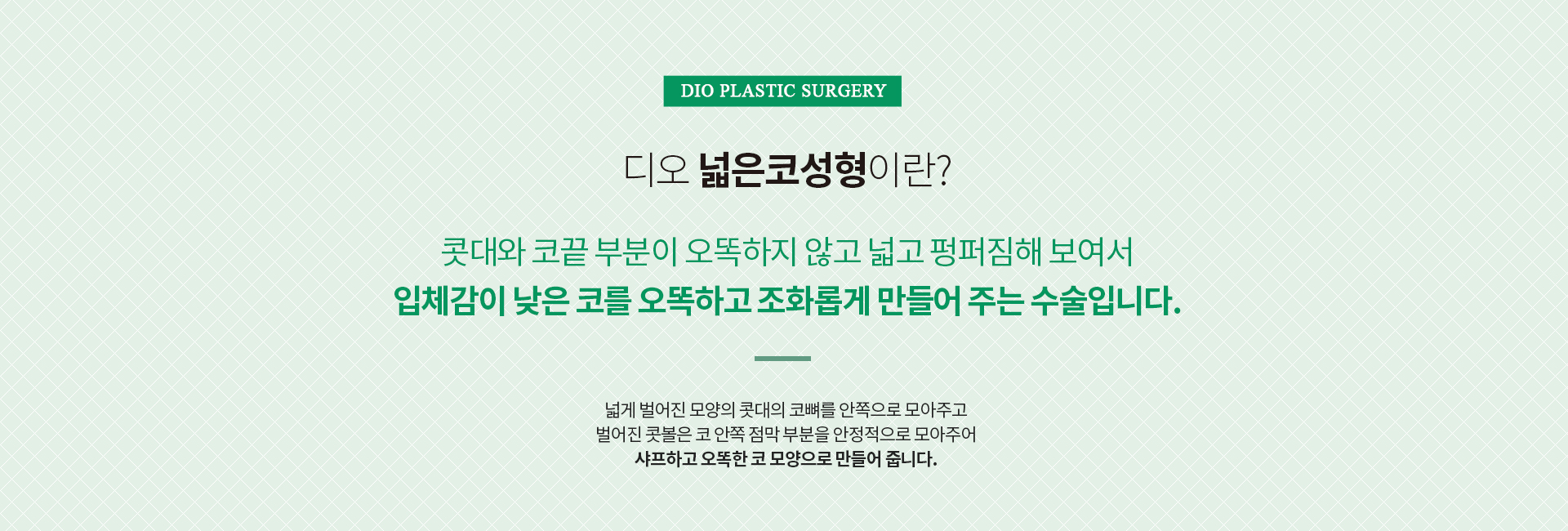넓은코성형이란? 