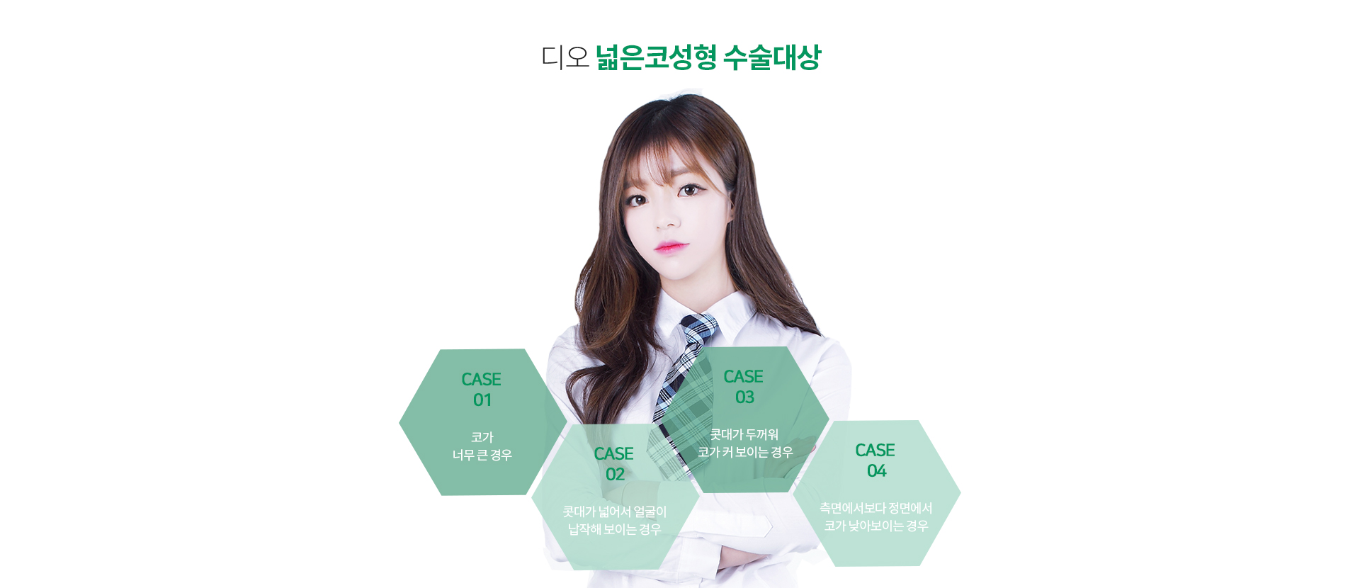 넓은코성형이 필요한경우