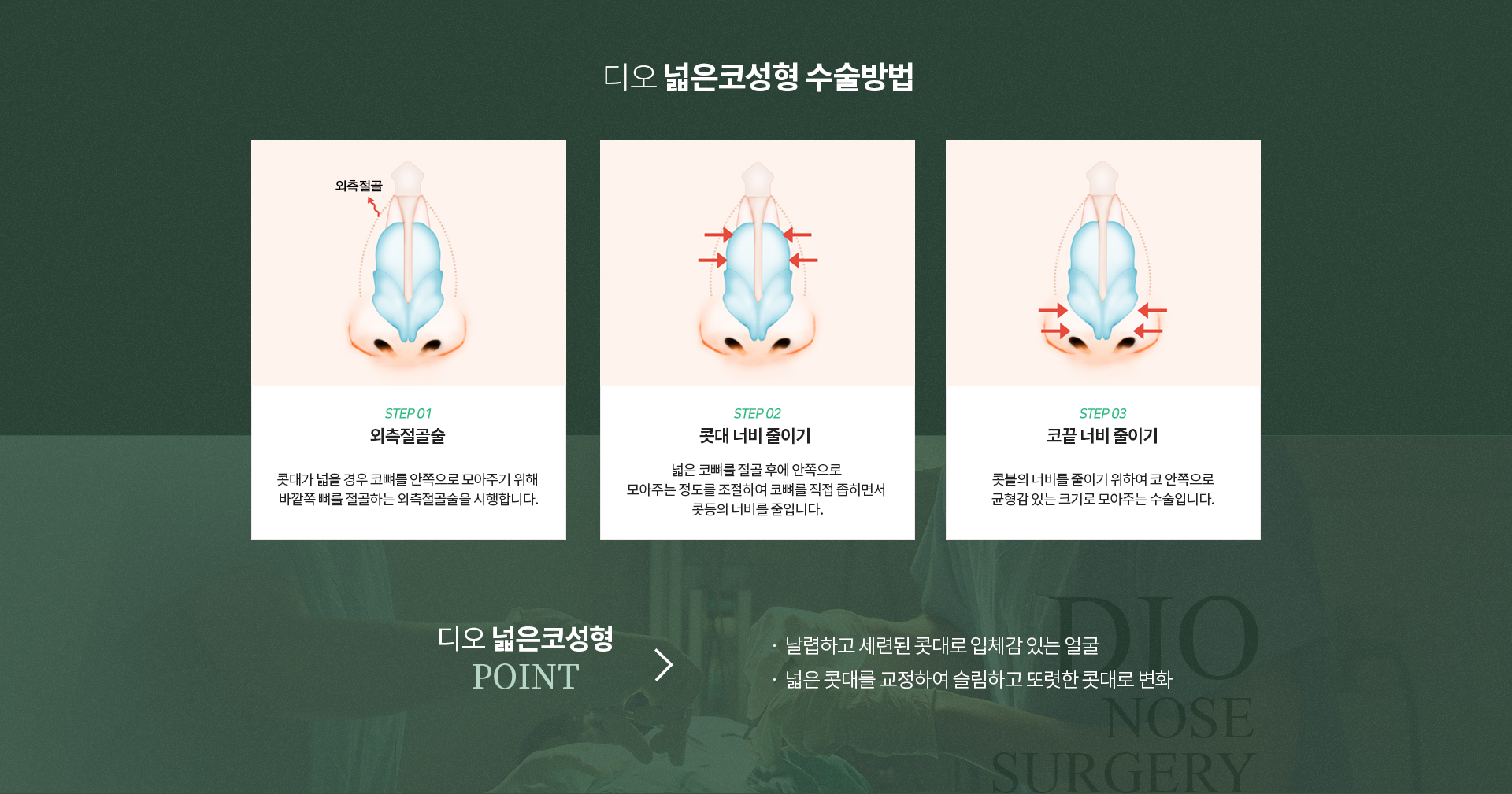 넓은코성형수술방법
