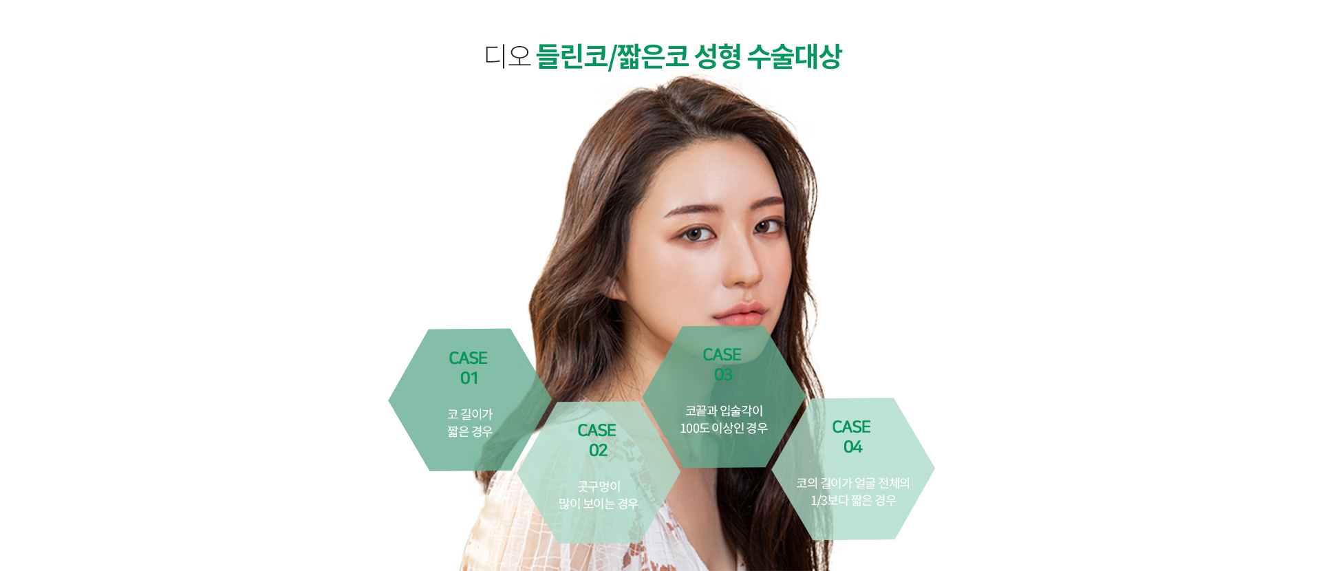 들린코/짧은코성형이 필요한경우