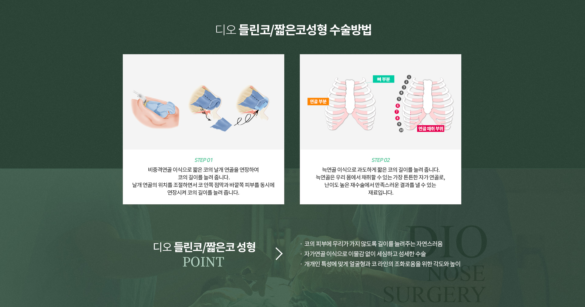 들린코/짧은코성형수술방법