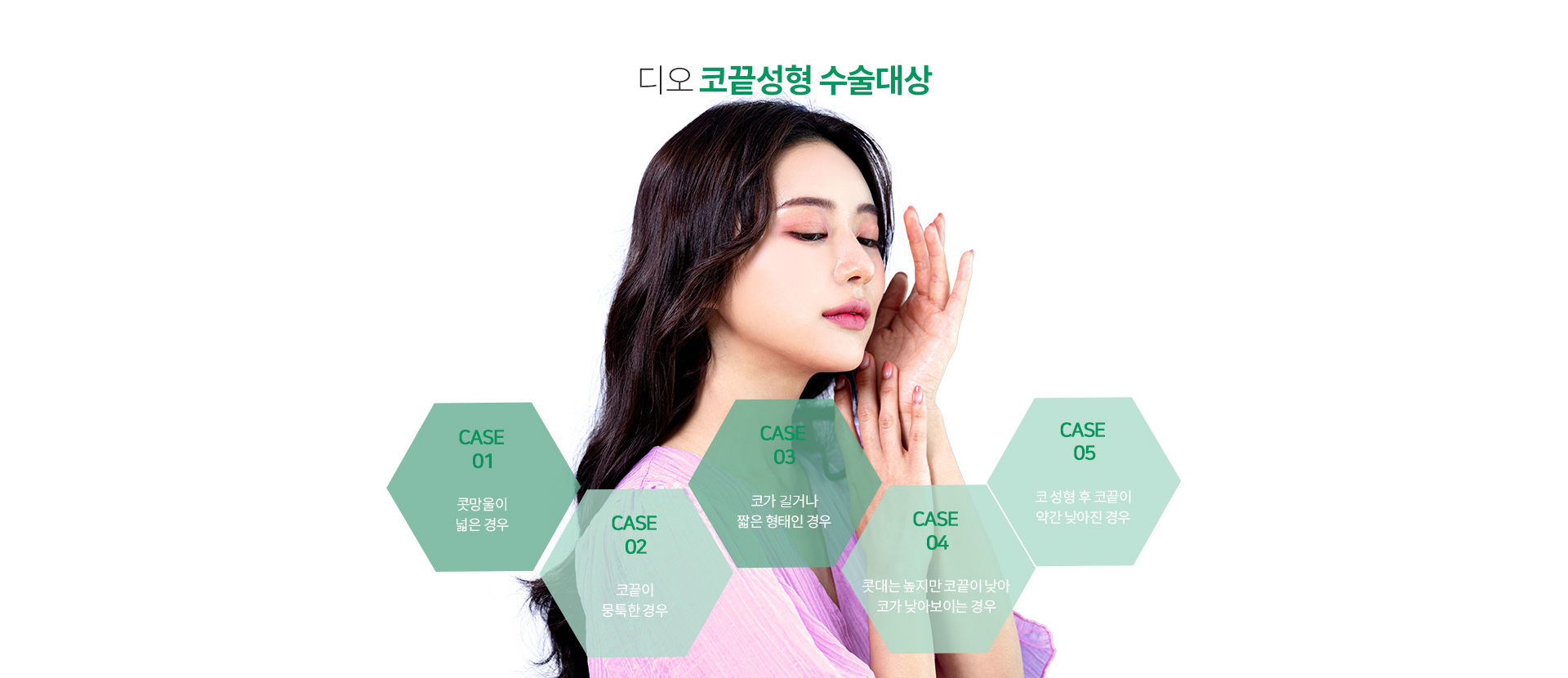 디오 코끝성형 수술대상 — 콧망울이 넓은 경우, 코끝이 뭉툭한 경우, 코가 길거나 짧은 형태인 경우, 콧대는 높지만 코끝이 낮아 코가 낮아보이는 경우, 코 성형 후 코끝이 약간 낮아진 경우