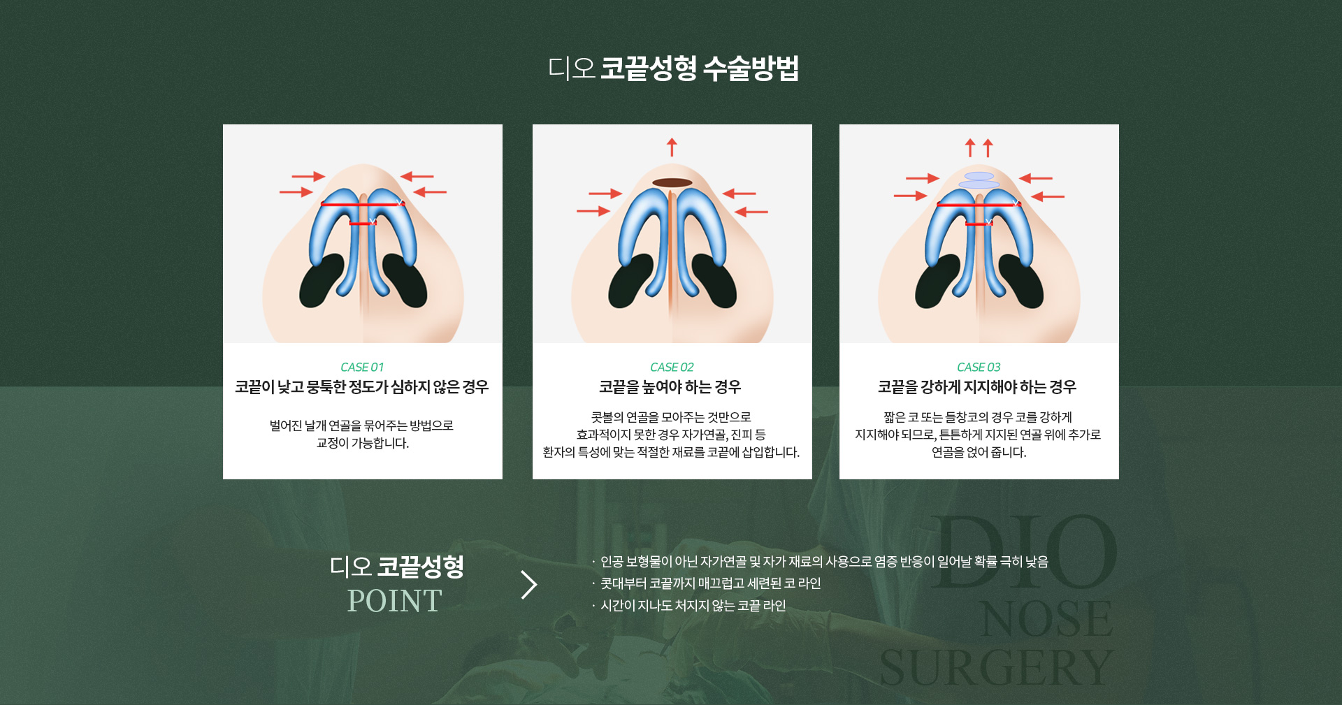 디오 코끝성형 수술방법 — 코끝이 낮고 뭉툭한 정도가 심하지 않은 경우 벌어진 날개 연골을 묶어주는 방법으로 교정, 코끝을 높여야 하는 경우 자가연골·진피 등 환자 특성에 맞는 재료를 코끝에 삽입, 코끝을 강하게 지지해야 하는 짧은 코나 들창코의 경우 지지된 연골 위에 추가로 연골을 얹음