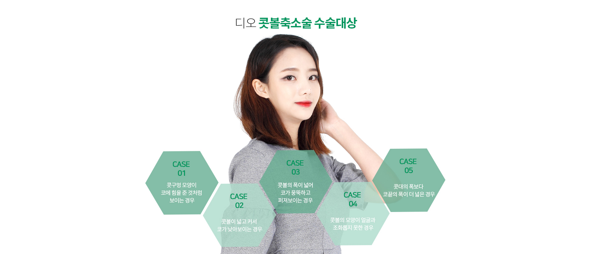 디오 콧볼축소술 수술대상 — 콧구멍 모양이 코에 힘을 준 것처럼 보이는 경우, 콧볼이 넓고 커서 코가 낮아보이는 경우, 콧볼의 폭이 넓어 코가 뭉뚝하고 퍼져보이는 경우, 콧볼의 모양이 얼굴과 조화롭지 못한 경우, 콧대의 폭보다 코끝의 폭이 더 넓은 경우