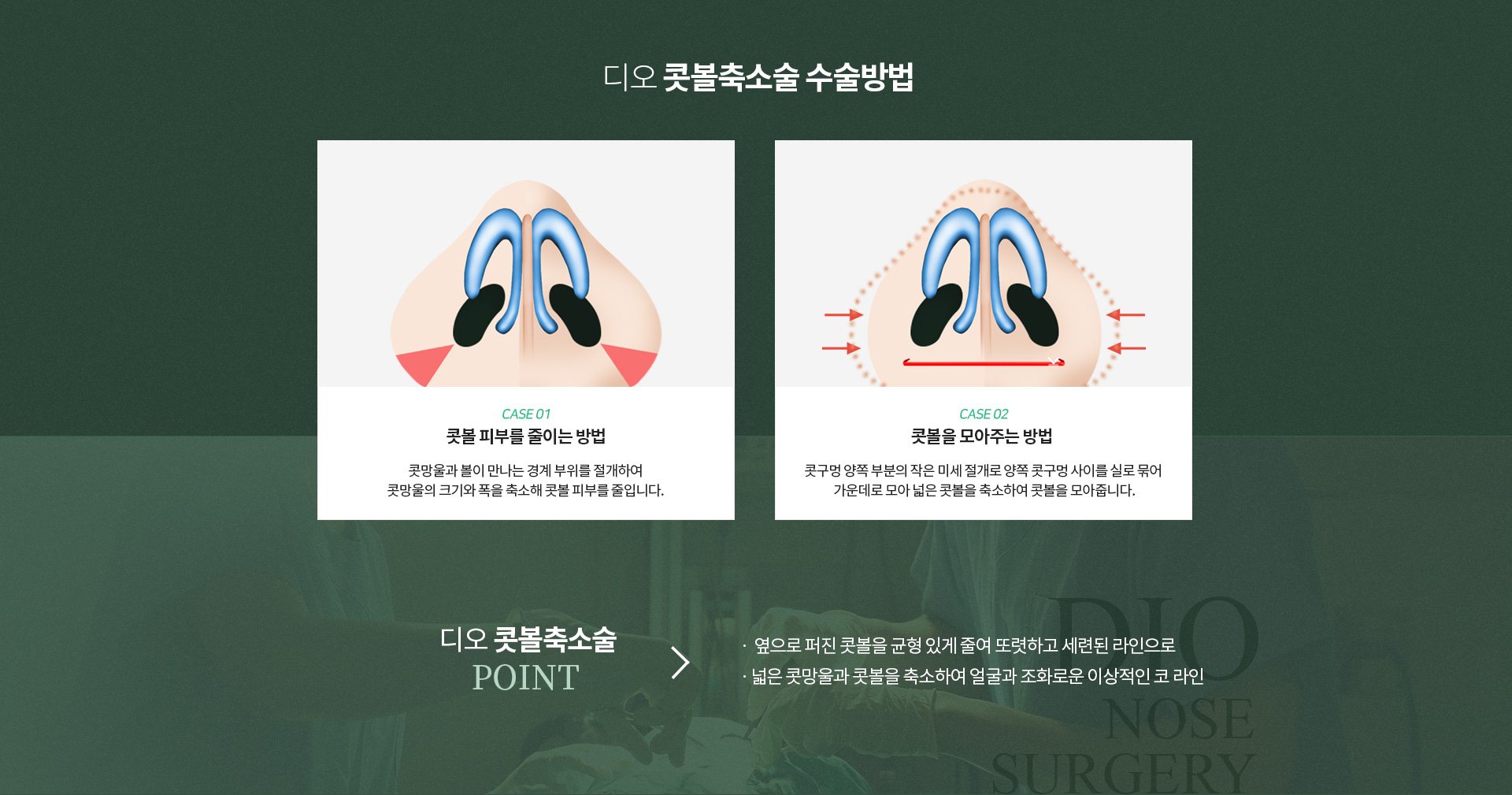 디오 콧볼축소술 수술방법 — 콧볼 피부를 줄이는 방법은 콧망울과 볼이 만나는 경계 부위를 절개해 콧망울의 크기와 폭을 축소, 콧볼을 모아주는 방법은 콧구멍 양쪽의 작은 미세 절개로 양쪽 콧구멍 사이를 실로 묶어 가운데로 모아 넓은 콧볼을 축소