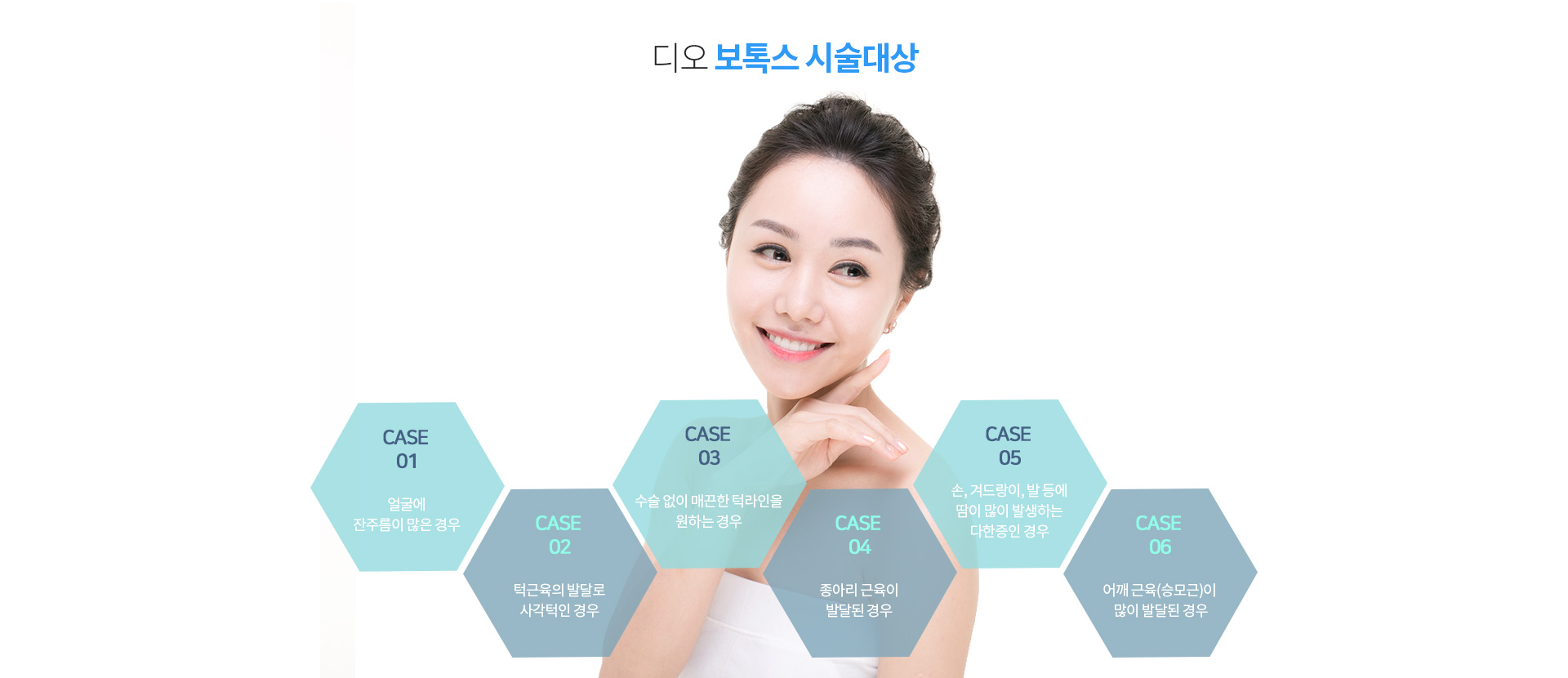 보톡스시술이 필요한 경우
