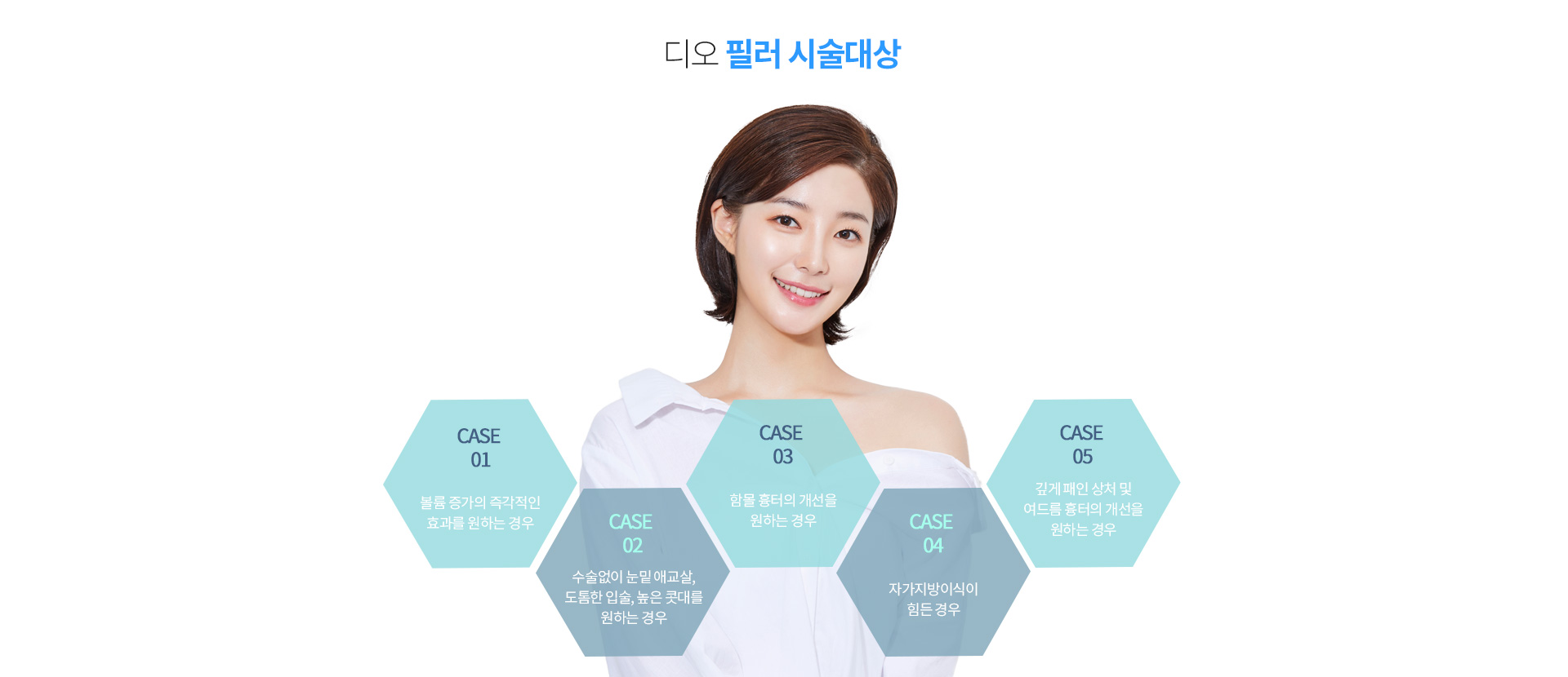 필러시술이 필요한 경우