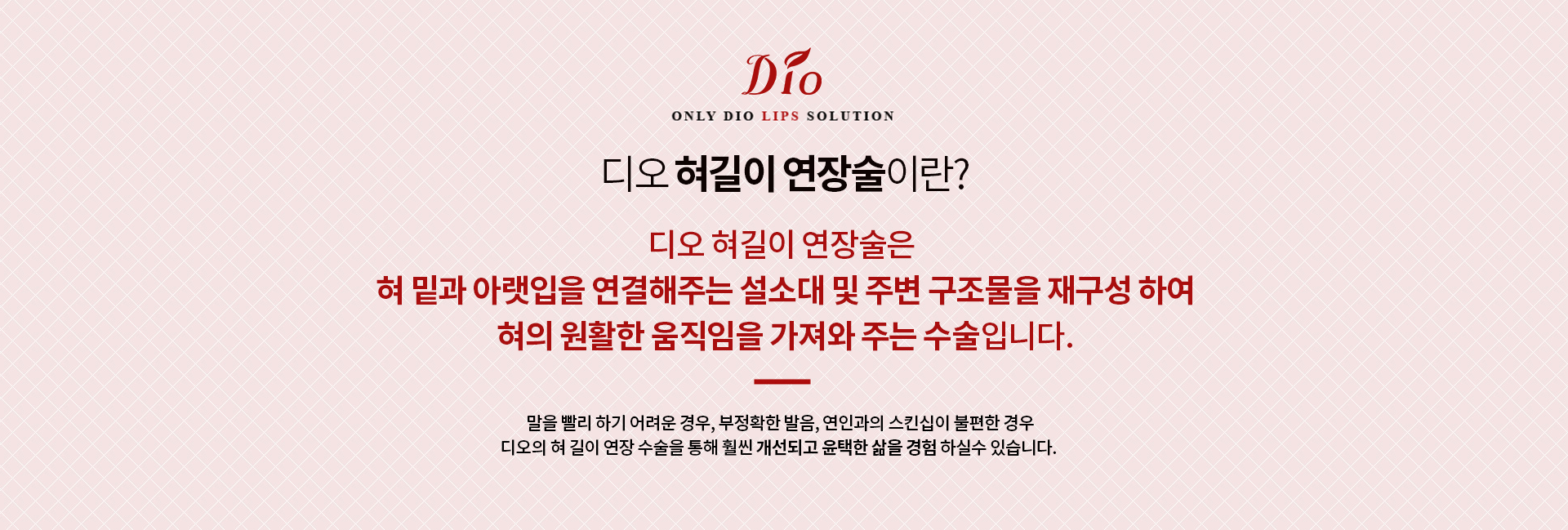 디오 혀길이 연장술이란? 혀 밑과 아랫입을 연결해주는 설소대 및 주변 구조물을 재구성하여 혀의 원활한 움직임을 가져와 주는 수술입니다
