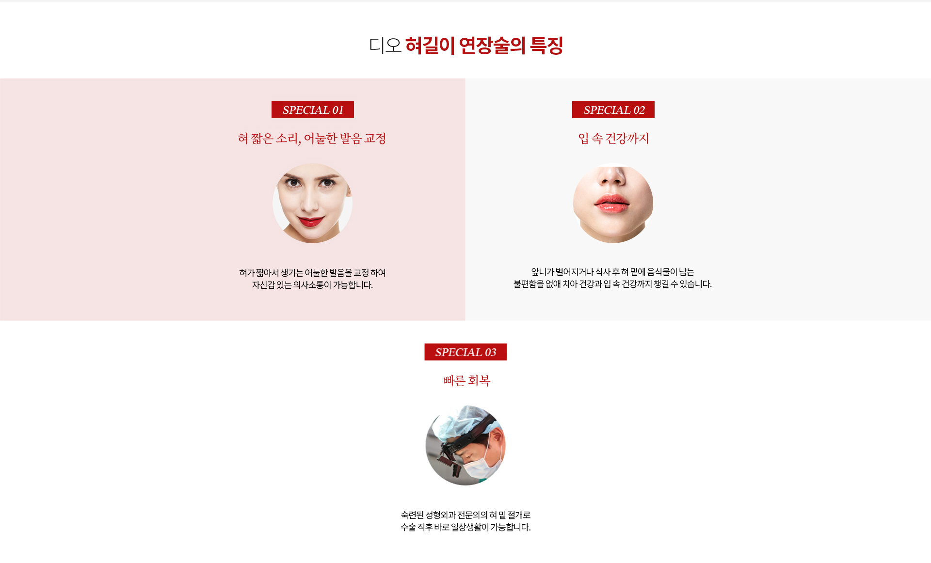 디오 혀길이 연장술의 특징 — 혀가 짧아서 생기는 어눌한 발음 교정, 앞니가 벌어지거나 식사 후 혀 밑에 음식물이 남는 불편함을 없애 치아 건강과 입 속 건강까지, 혀 밑 절개로 수술 직후 바로 일상생활 가능